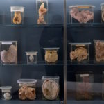 Vienna exhibition tests ethics of displaying human remains